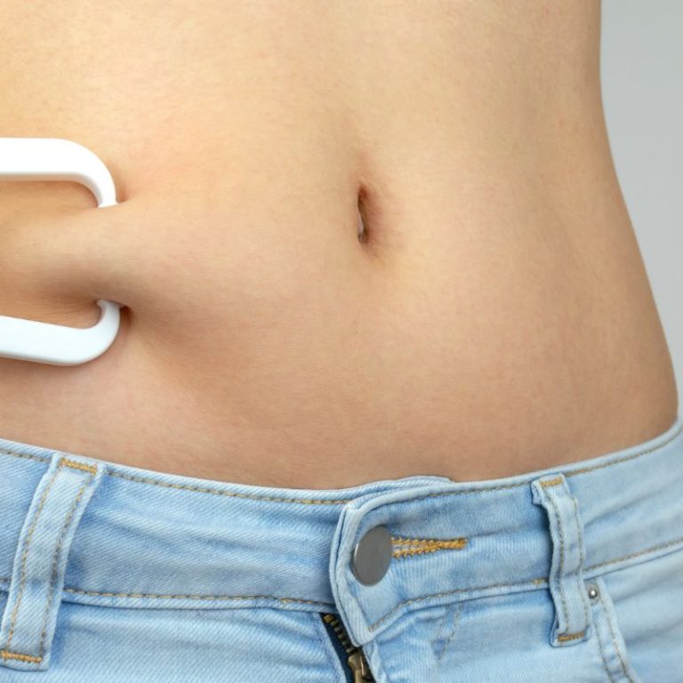 grasa localizada (1)